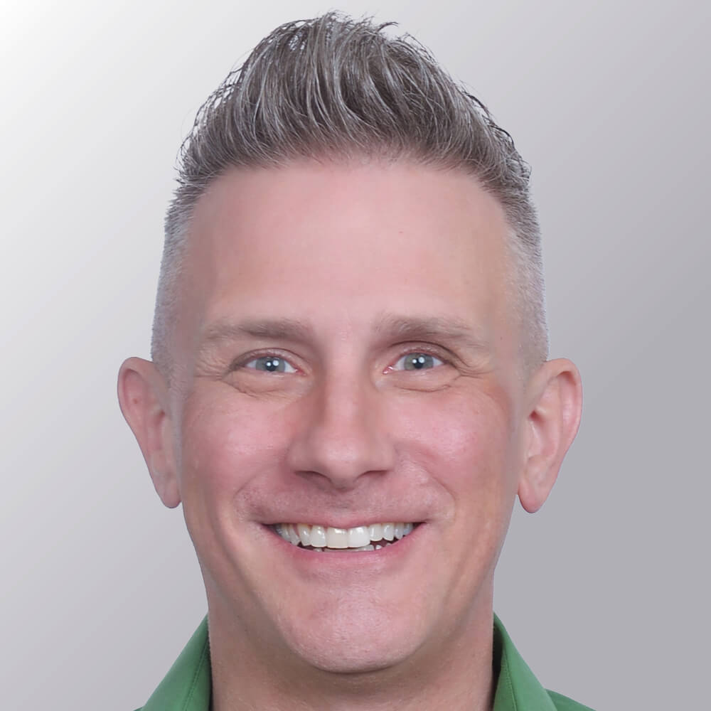 Kevin B. after hair transplant