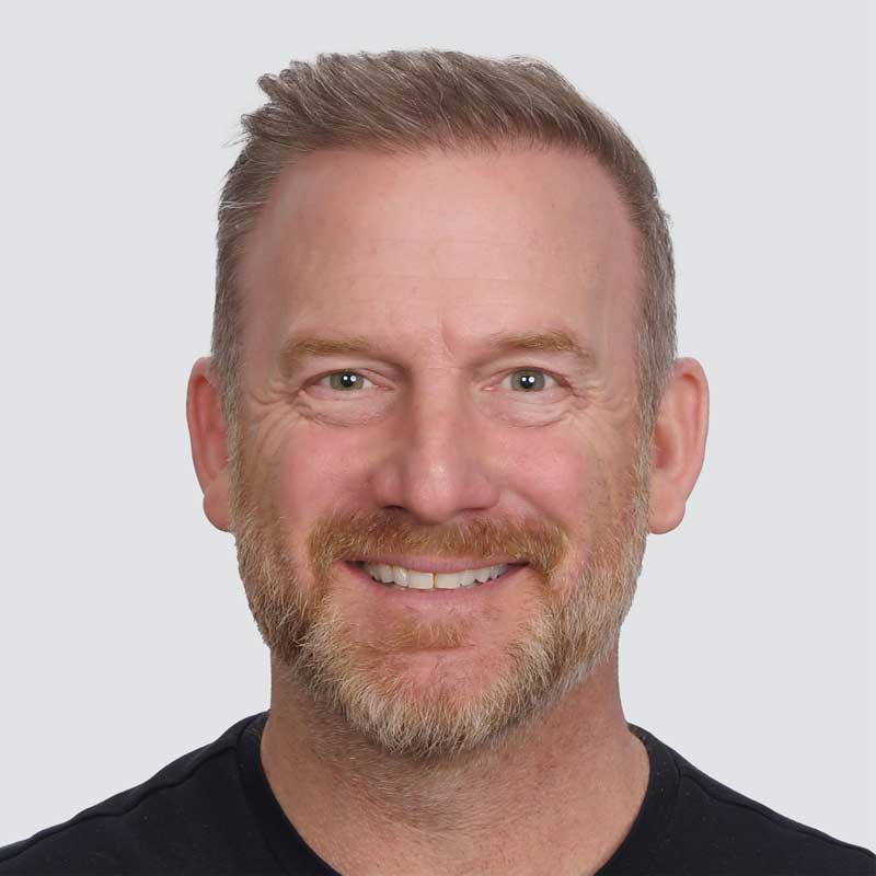 Ryan Dempster after hair transplant