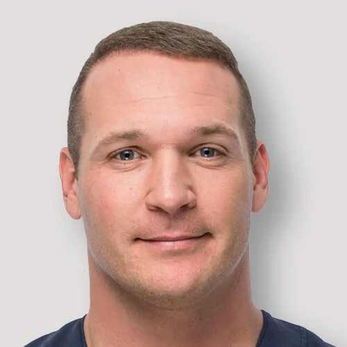 Brian Urlacher after hair transplant