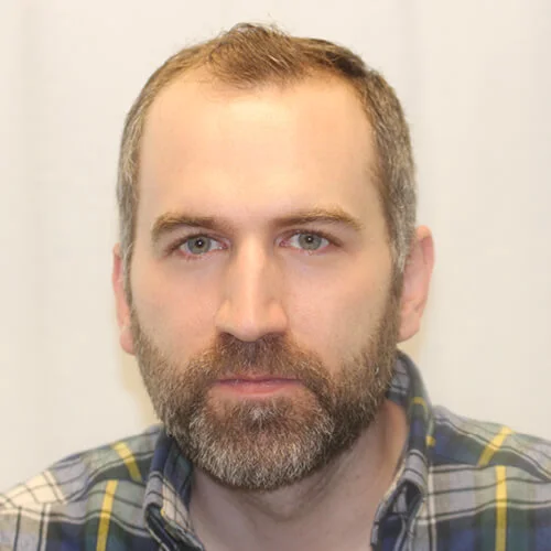 Drew J. before hair transplant