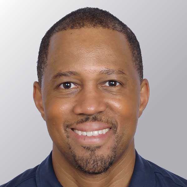 Donnie B. after hair transplant