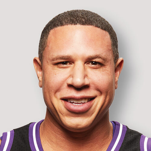 Mike Bibby after hair transplant