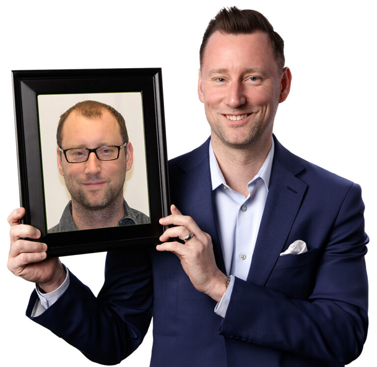 Jake W, RESTORE Client, holding a before photo of his hair loss