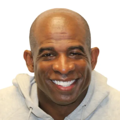 Deion Sanders before hair transplant