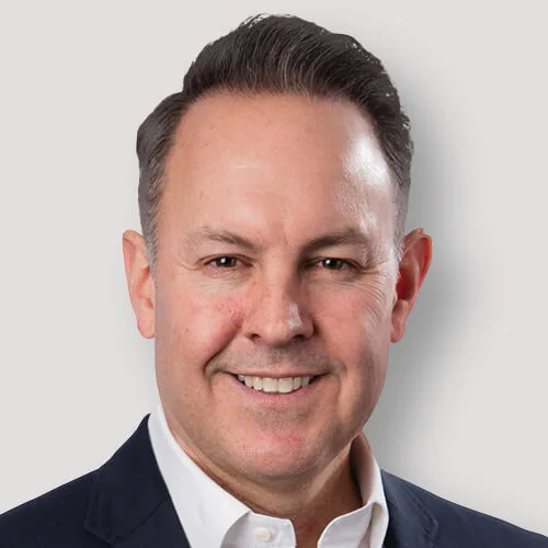 Jamie S. after hair transplant