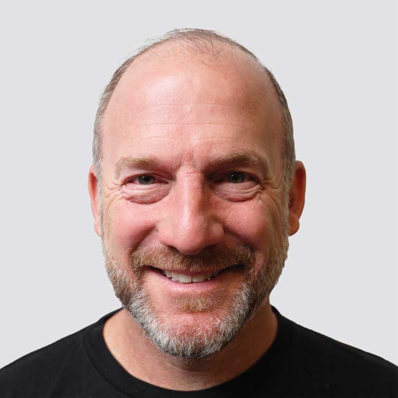 Ryan Dempster before hair transplant