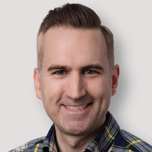 Drew J. after hair transplant