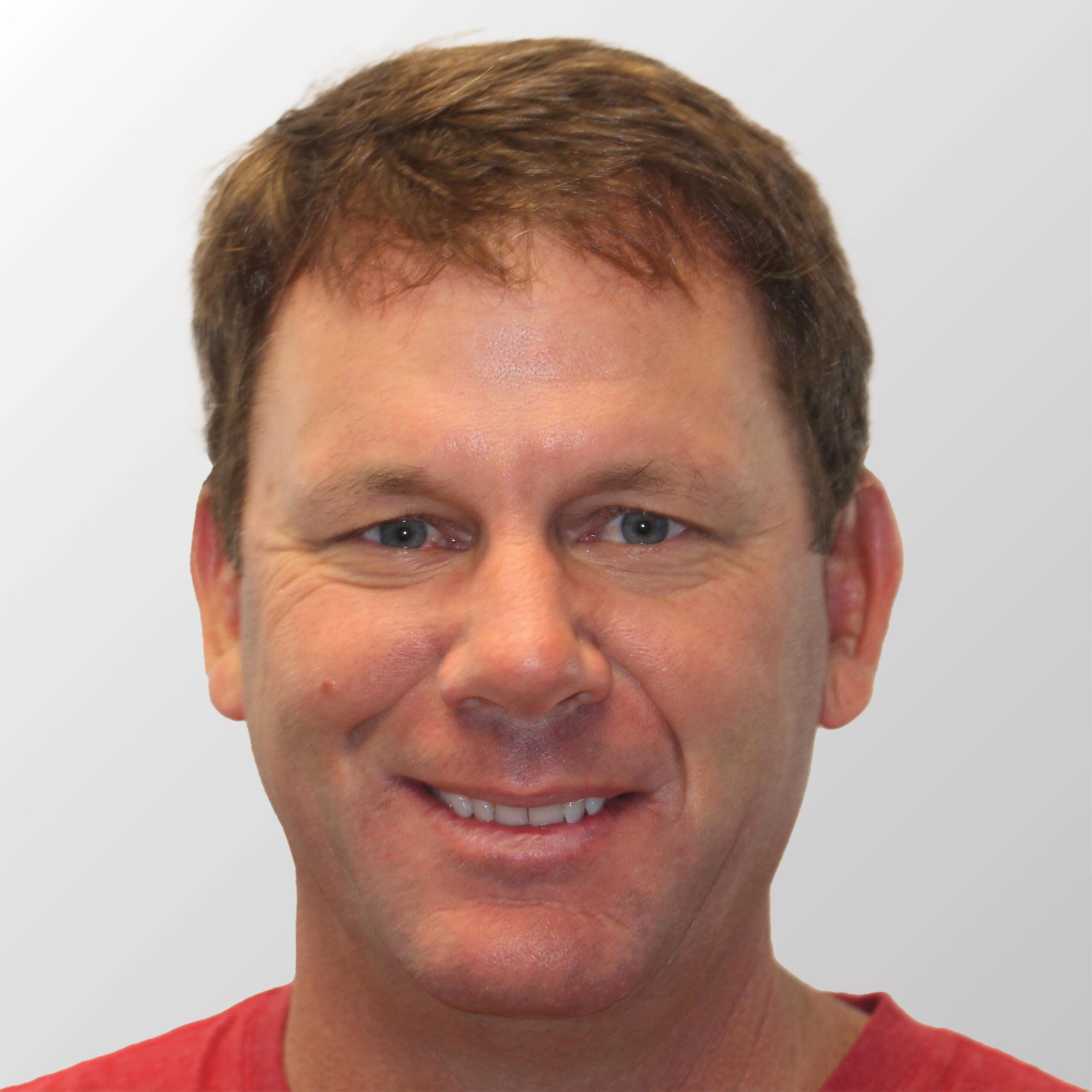 Kevin VanDam before hair transplant