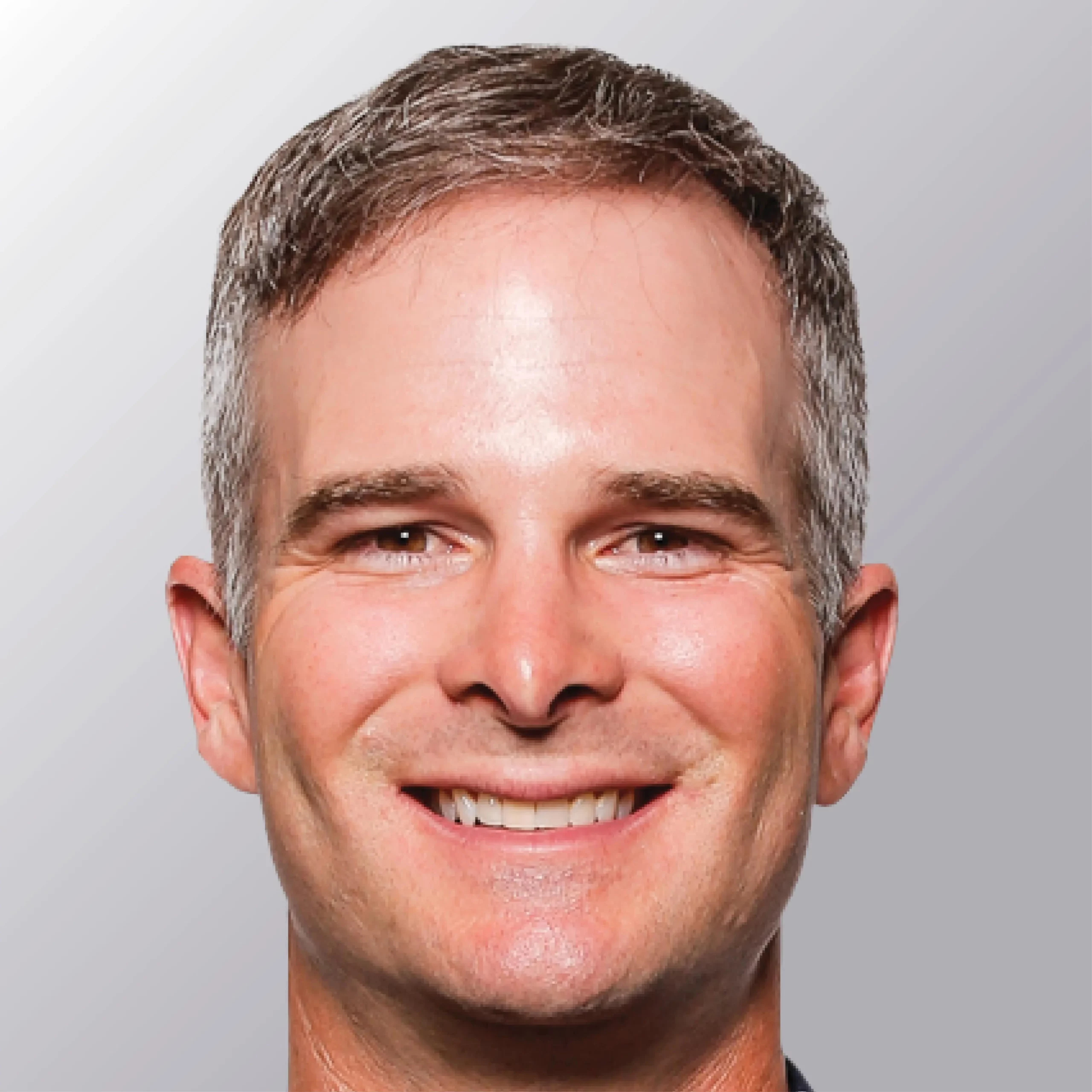 Kevin Streelman after hair transplant