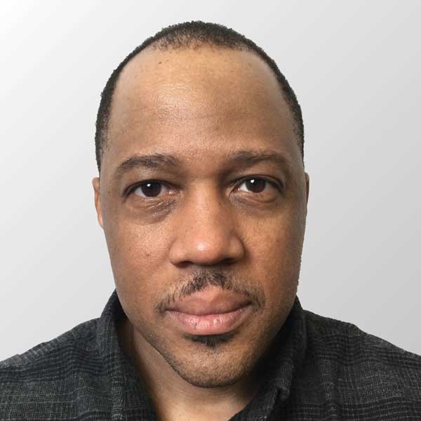 Donnie B. before hair transplant