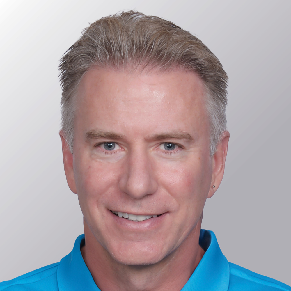 Rick M. after hair transplant