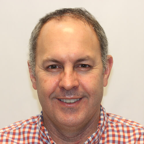 Jamie S. before hair transplant