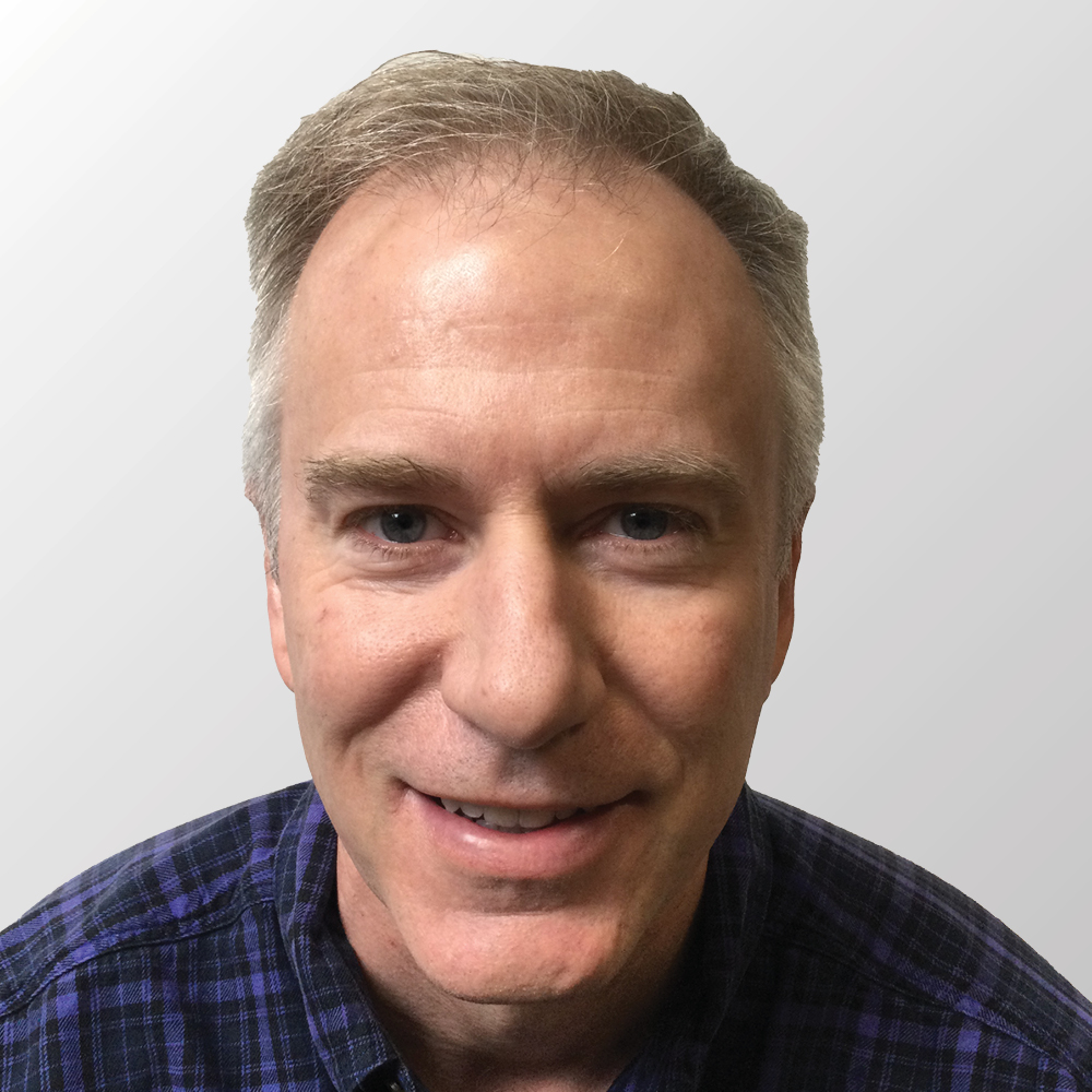 Rick M. before hair transplant