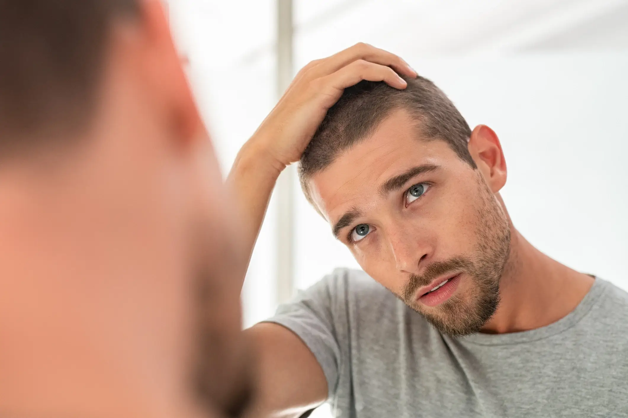 RESTORE Hair patient considering hair restoration